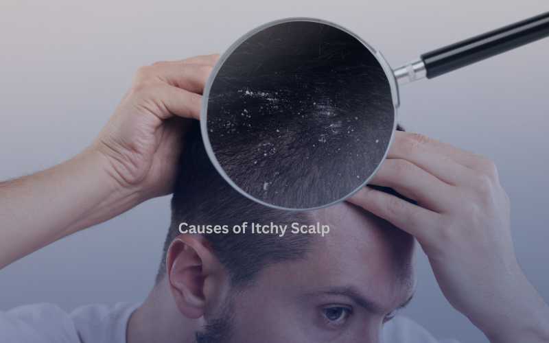 Causes of Itchy Scalp