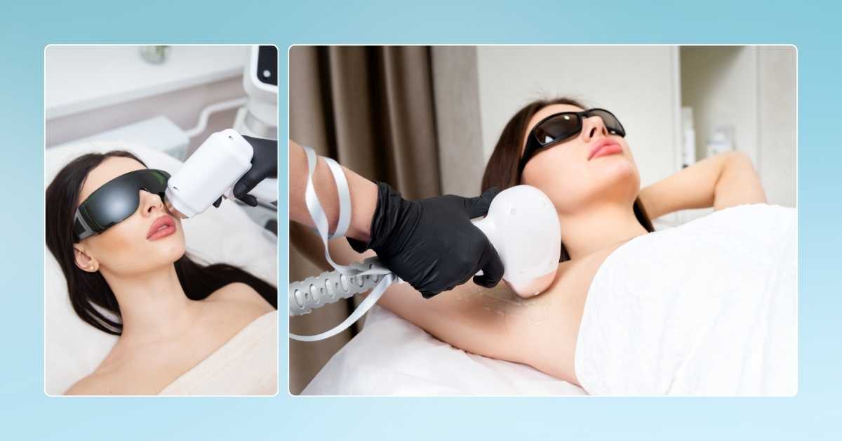 Home Laser Hair Removal